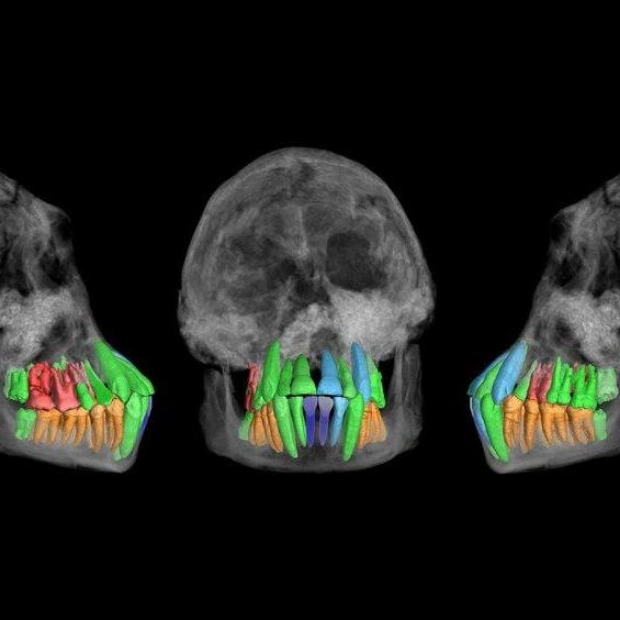 Ancient Homo Species Showed Early Signs of Extended Childhood