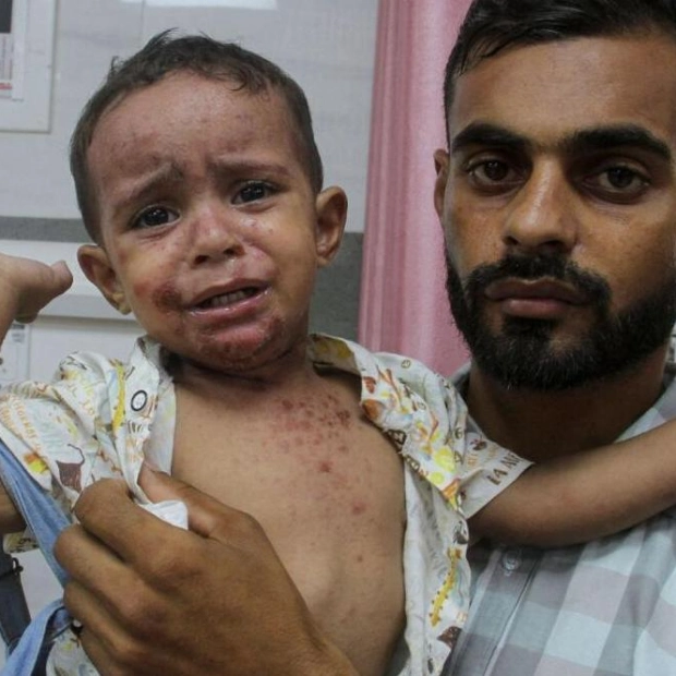 Gaza's Children Plagued by War and Disease Amidst Humanitarian Crisis