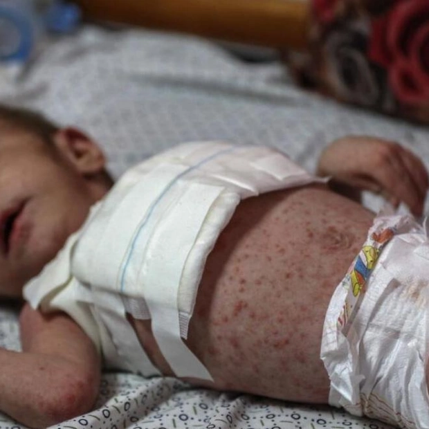 Gaza's Children Struggle with Skin Infections Amid War