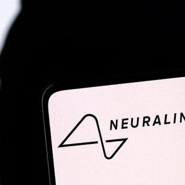 Нолан Арбо: Первый человек с имплантом Neuralink изучает языки