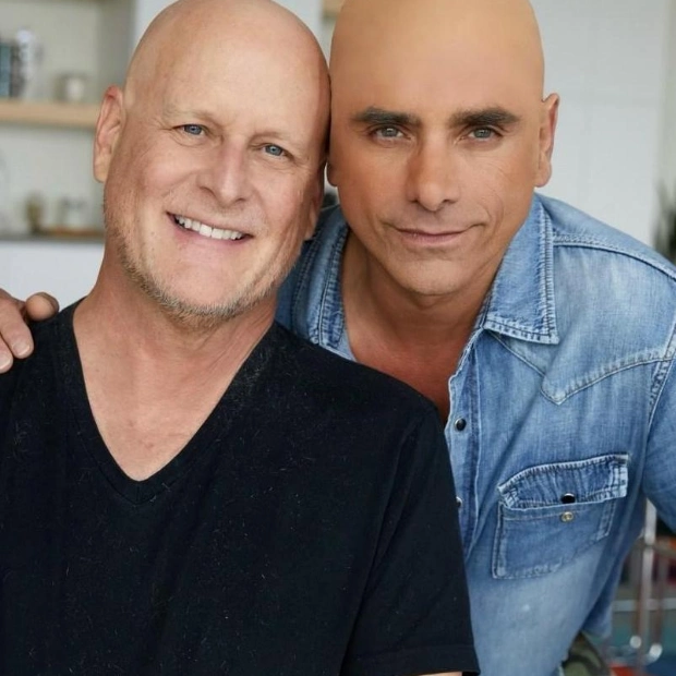 John Stamos Responds to Critics Over Bald Cap Gesture