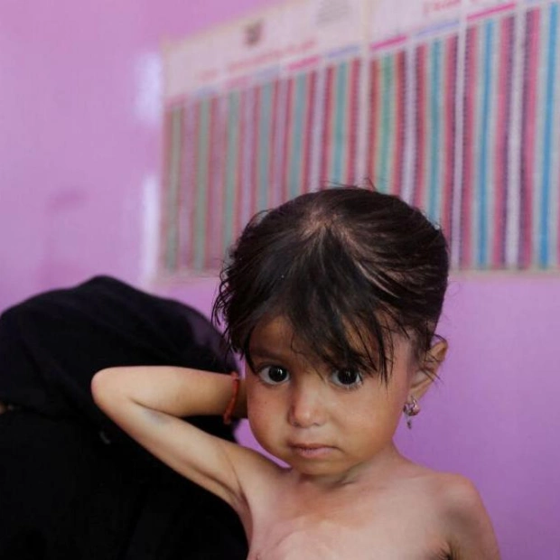 Acute Malnutrition Spikes in Government-Controlled Yemen