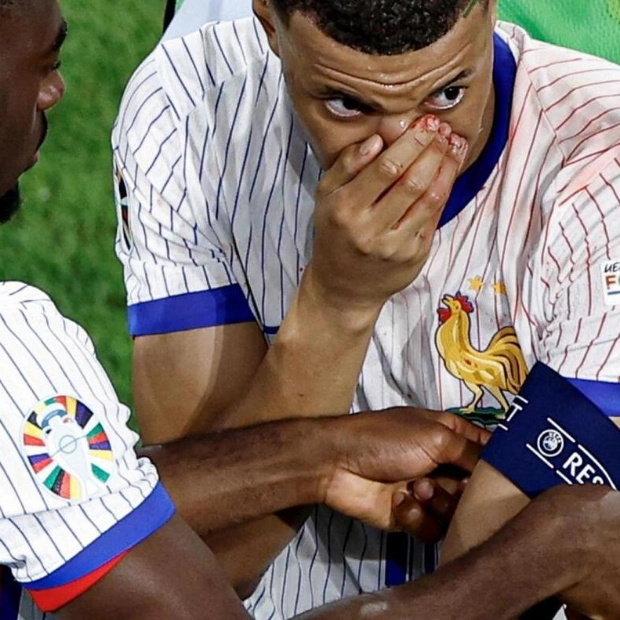 Kevin Danso Sympathizes with Injured Kylian Mbappe After Euro 2024 Clash