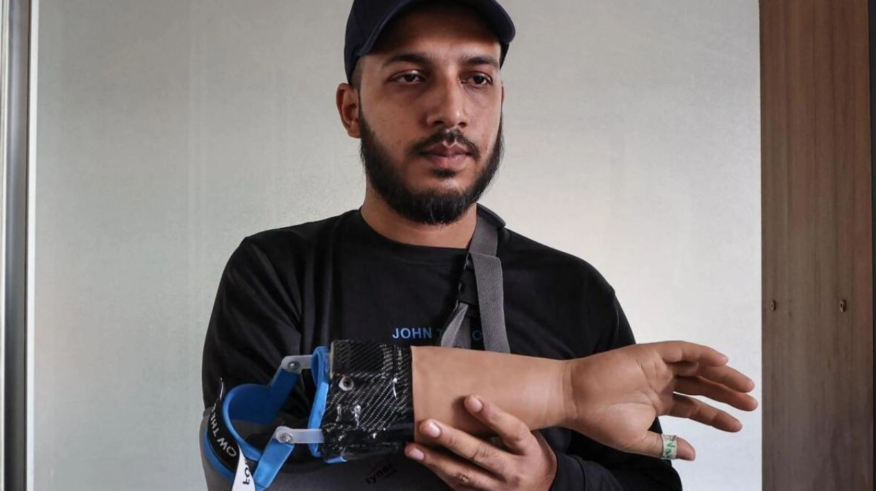 Bangladesh Protesters Test Robotic Prosthetic Hands