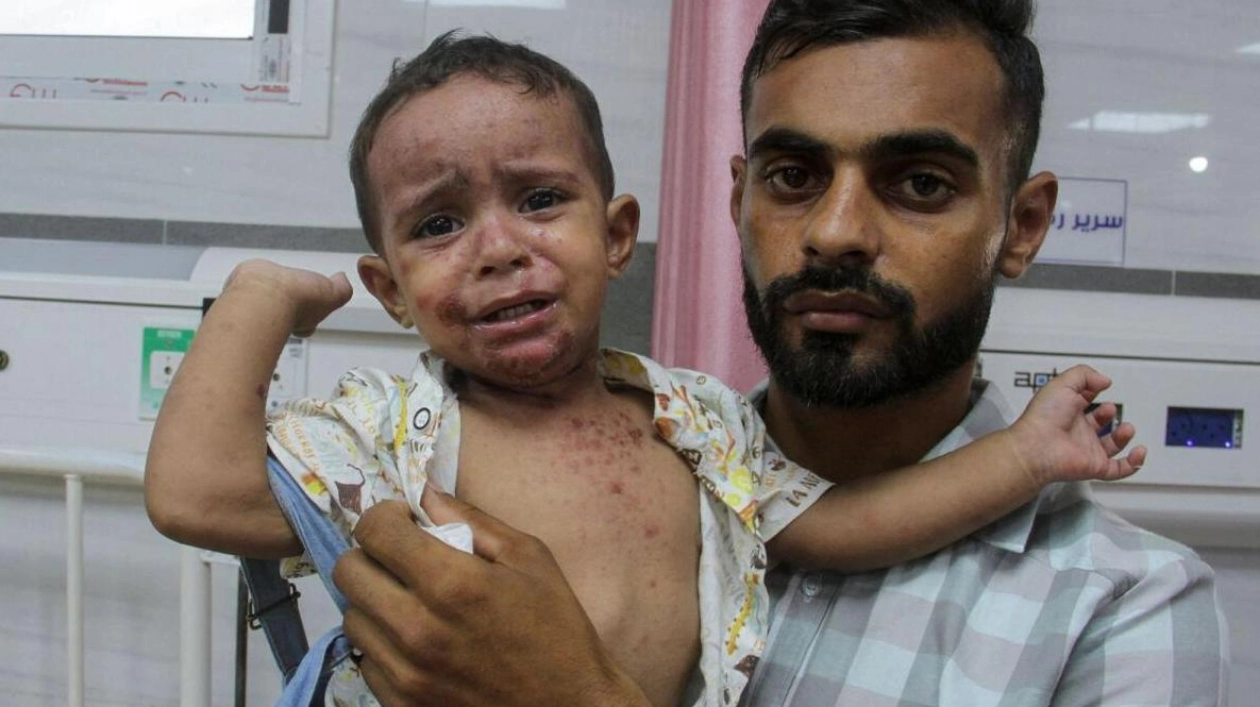 Gaza's Children Plagued by War and Disease Amidst Humanitarian Crisis