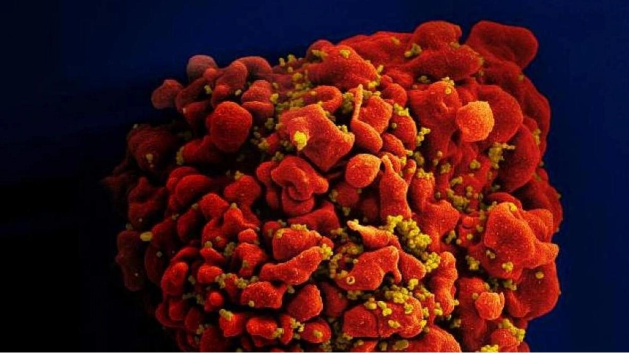 German Man Likely Seventh to Be Cured of HIV Through Stem Cell Transplant