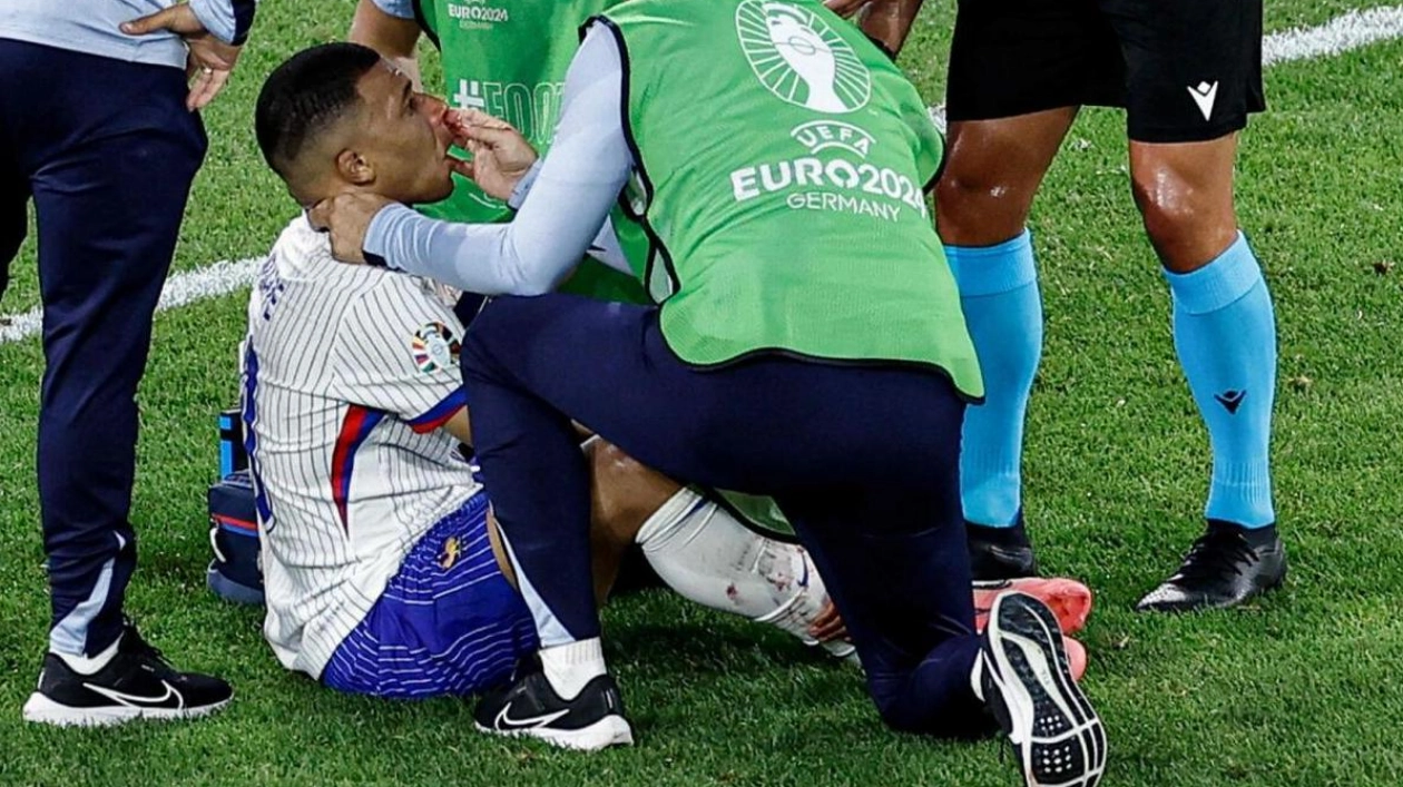 Kylian Mbappe's Nose Injury Puts Euro 2024 Match in Doubt