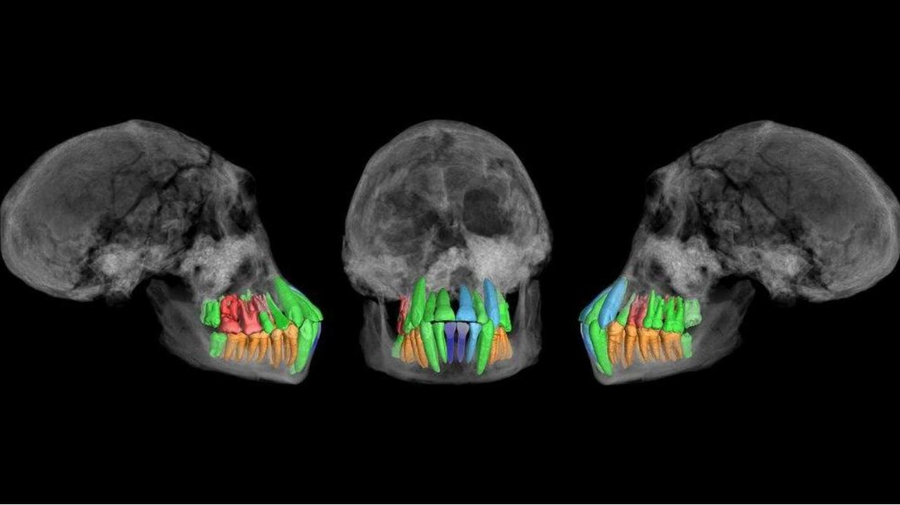 Ancient Homo Species Showed Early Signs of Extended Childhood